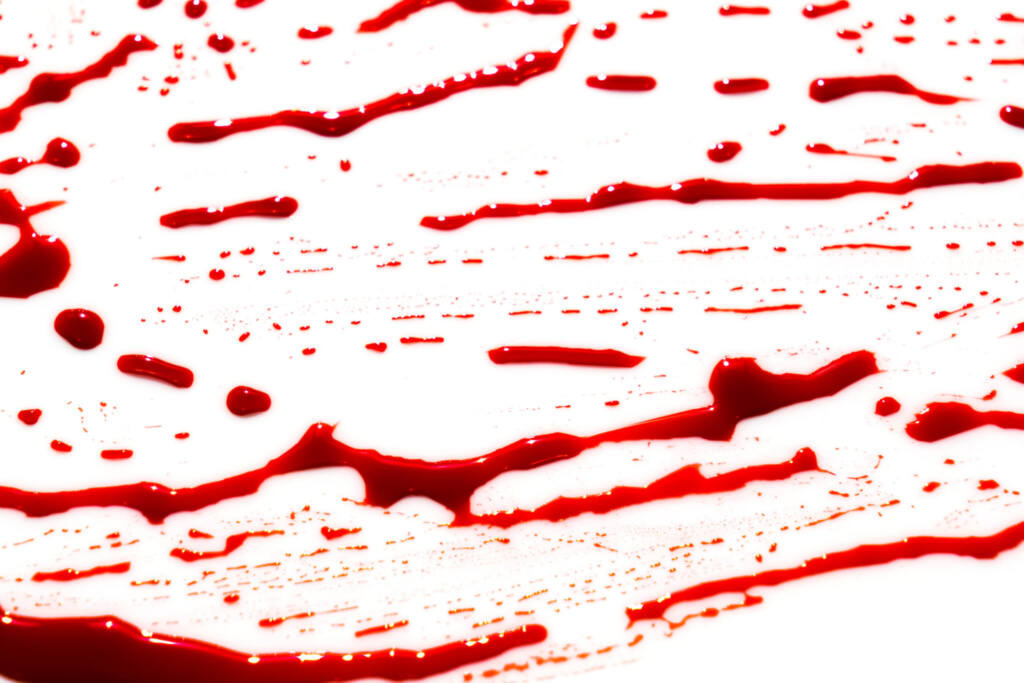 Blood Evidence Blood Stain Pattern Analysis